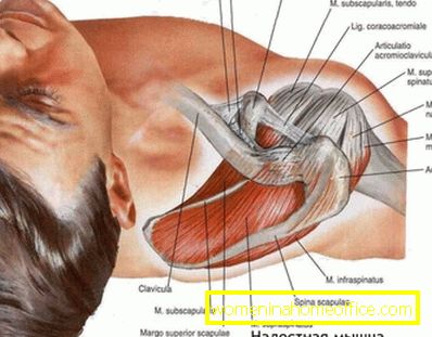 Qu'est-ce qu'une périarthrite huméro-scapulaire?